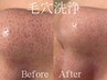 【毛穴・皮脂・ざらつき】全顔毛穴リセット◇サブスク対応◎