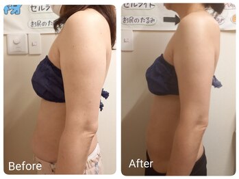 スマイルボディ つぼの森 加治木店(Smile body)/痩身☆トリプルマシン