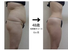 エステ&ビューティストレッチ プチルポの雰囲気（エンダモロジーは、日本上陸と共に扱い始め25年目。プロの神業！）