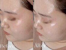 ウィハナ(wehana)/【ララピール】はり/艶/毛穴