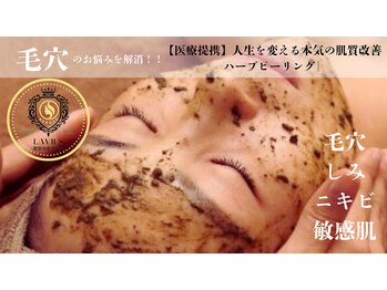 ラビエス(LAVIES)