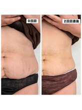 リアリア(LEALEA)/レモンボトル×ノアグロウ