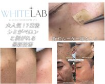 エム(M)
