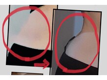 アウローラ 立川店(Aurora)/一度でくびれ実感骨盤ケア