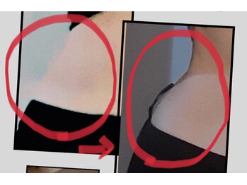 アウローラ 立川店(Aurora)/一度でくびれ実感骨盤ケア