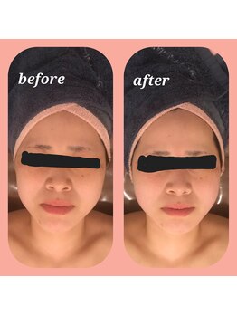 ウララン(URARAN)/コルギのお客様