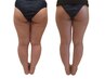 【キュッと引き締まった美尻へ☆】美尻コース30分¥7700→¥5500