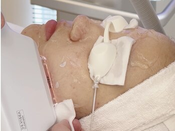 ナトラ 蔵前の写真/お肌に優しい顔脱毛♪剃ることも、抜くこともできない、毛穴の奥に詰まった厄介な毛もお任せ下さい◎