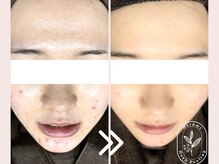ハルミ美容整体 渋谷(Harumi美容整体)