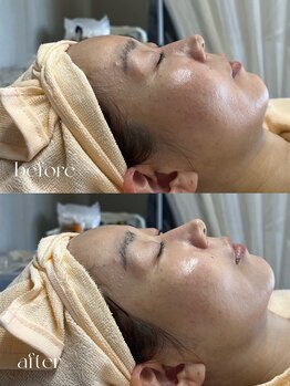 ユードット(u.)/ララピール(kaho担当)