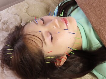 ハウオラ 三軒茶屋(HAUOLA)/施術【美容鍼/小顔/むくみ】