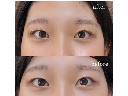 レコルトアイラッシュ(RECOLTE EYELASH)の写真