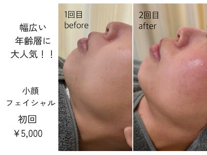 ほねつぎ一休さん 宇品店の写真