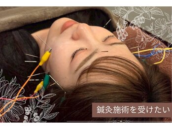ナナラ鍼灸(NANALA鍼灸)の写真/鍼灸で全身アプローチ!痩身・肩凝り・小顔・毛穴に◎痩身マシン&強力もみだし!ヘッドマッサージも♪