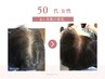 【レディース育毛促進コース】カウンセリング11000→2980円