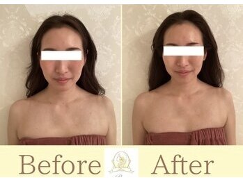 リコ(Rico)/フェイスラインが別人級に！