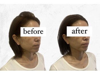 ビーアイリー(Be irie)/フェイシャルエステ直後の変化