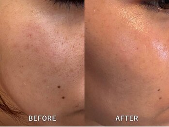 エリンダ(E LINDA)/