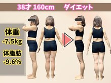 ほんじょう整骨院 美容整体/北九州/八幡西区/ダイエット