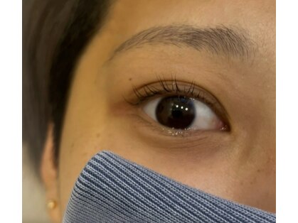 ソルテ(Sorte)の写真