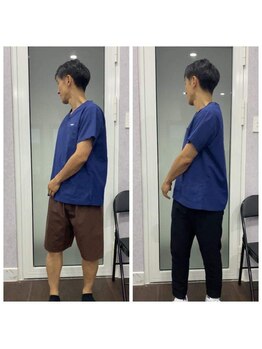 ナゴミ(和 nagomi)/再生鍼