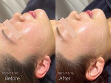 ラティエ(Latier)/憧れのツヤ肌が手に入る♪