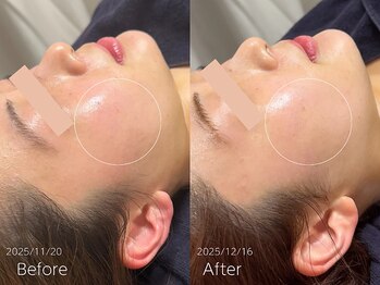 ラティエ(Latier)/憧れのツヤ肌が手に入る♪