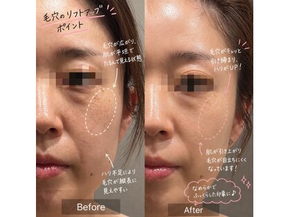 トータルビューティ リライフ(Total beauty Relife)の写真