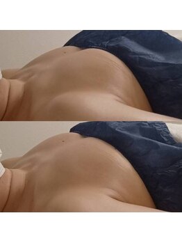 ミリミリ(mili mili)/before→after