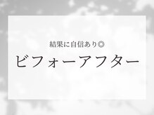 ホクサイ プレミアムサロン(HOKUSAI PREMIUM SALON)/結果に自信◎ビフォーアフター