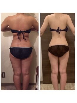 エステサロン 美飾り イオンモール木更津店/before⇒after/全身痩せ