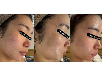 クリア 麻布十番(CLEAR)の写真