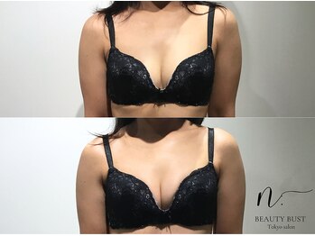 エヌドット 日本橋(N.)/印象を変えるバストマッサージ!