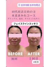 ヨサパーク ラブリエ 吉祥寺店(YOSA PARK La Briller)/初回から見た目変化実感！