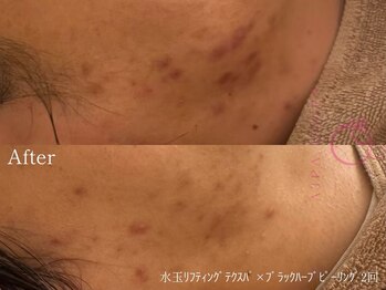 サロンヴェアリー 広尾(salon vary)/お悩みの根本改善に！