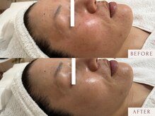 クラームビューティー(Clerm beauty)/【40代 女性】鎮静フェイシャル