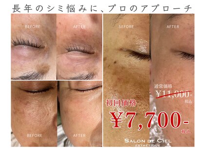 サロンドシエル カスガイ(Salon de Ciel kasugai)の写真