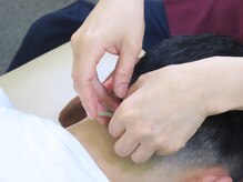 ワセダ接骨鍼灸マッサージ院の雰囲気(1日中立ちっぱなしの腰痛・足の疲れに。深部まで解きほぐす)