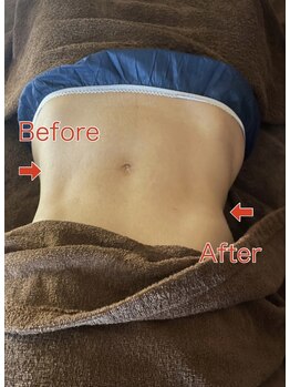 ヨサパーク ヴィヴァン(YOSAPARK Vivant)/無くしたくびれを取り戻す！