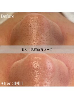 アール アンド ビューティーサロン(Ｒ＆ BeautySalon)/ホームケアまでサポートします