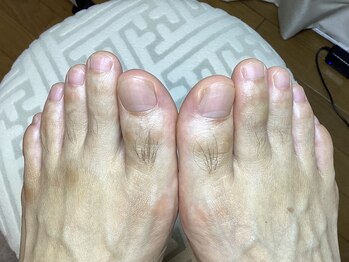 フットケアリストシュウ(footcarelist shu)/施術 フットケア《メンズOK 》