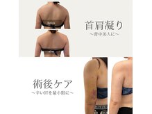 リセ(RESE)の雰囲気（インディバ温熱で凝り解消で見た目にも変化が◎/術後ケアも◎）