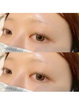 トイ 川口(toi.)/ラッシュリフト or パリジェンヌ