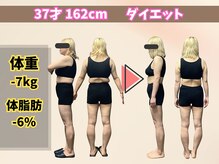 ほんじょう整骨院 美容整体/北九州/八幡西区/ダイエット