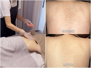 ジュエリーボディー(Jewelry body)