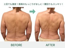 ドクタープラント 北心斎橋店(DR PLANT)/１回で劇的変化！