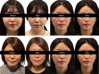 アロエベル(aloe Belle)