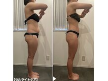 ミエル 恵比寿店(Miel)の雰囲気（ダイエット/体質/ブライダルエステで大人気のボディメニュー）