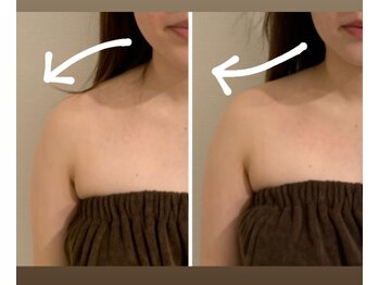 スリーメイ(3mey)/肩ハリ解消