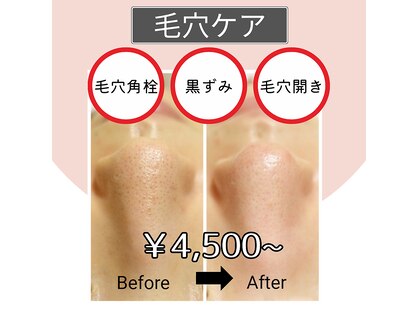 ユフラ(Yufla)の写真